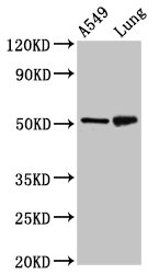 IRX3 Antibody - Positive Western Blot detected in A549 whole cell lysate, Rat lung tissue. All lanes: IRX3 antibody at 5 µg/ml Secondary Goat polyclonal to rabbit IgG at 1/50000 dilution. Predicted band size: 53 KDa. Observed band size: 53 KDa