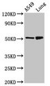 IRX3 Antibody - Positive Western Blot detected in A549 whole cell lysate, Rat lung tissue. All lanes: IRX3 antibody at 5 µg/ml Secondary Goat polyclonal to rabbit IgG at 1/50000 dilution. Predicted band size: 53 KDa. Observed band size: 53 KDa
