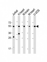 IRX4 Antibody - All lanes: Anti-IRX4 Antibody (C-Term) at 1:2000 dilution Lane 1: Jurkat whole cell lysate Lane 2: human heart lysate Lane 3: mouse brain lysate Lane 4: mouse heart lysate Lane 5: U-2OS whole cell lysate Lysates/proteins at 20 µg per lane. Secondary Goat Anti-Rabbit IgG, (H+L), Peroxidase conjugated at 1/10000 dilution. Predicted band size: 54 kDa Blocking/Dilution buffer: 5% NFDM/TBST.
