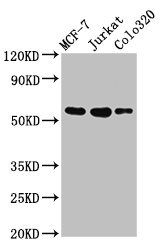 IRX4 Antibody - Positive Western Blot detected in MCF-7 whole cell lysate, Jurkat whole cell lysate, COLO320 whole cell lysate. All lanes: IRX4 antibody at 3 µg/ml Secondary Goat polyclonal to rabbit IgG at 1/50000 dilution. Predicted band size: 55, 58 KDa. Observed band size: 55 KDa