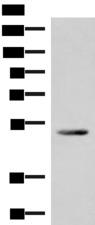 IRX4 Antibody - Western blot analysis of Mouse heart tissue lysate  using IRX4 Polyclonal Antibody at dilution of 1:400