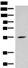 IRX4 Antibody - Western blot analysis of Mouse heart tissue lysate  using IRX4 Polyclonal Antibody at dilution of 1:400