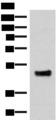 IRX5 Antibody - Western blot analysis of Mouse lung tissue lysate  using IRX5 Polyclonal Antibody at dilution of 1:300