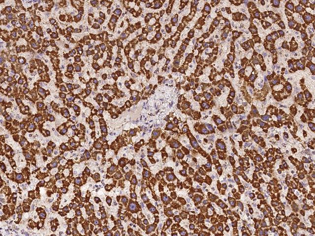 IRX6 Antibody - Immunochemical staining of human IRX6 in human liver with rabbit polyclonal antibody at 1:500 dilution, formalin-fixed paraffin embedded sections.