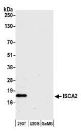 ISA2 / ISCA2 Antibody - Detection of human ISCA2 by western blot. Samples: Whole cell lysate (50 µg) from HEK293T, U20S, and GaMG cells prepared using NETN lysis buffer. Antibody: Affinity purified rabbit anti-ISCA2 antibody used for WB at 1:1000. Detection: Chemiluminescence with an exposure time of 30 seconds.