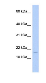 ISA2 / ISCA2 Antibody - ISCA2 / HBLD1 antibody Western blot of Fetal Thymus lysate. This image was taken for the unconjugated form of this product. Other forms have not been tested.