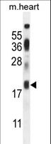 ISA2 / ISCA2 Antibody - ISCA2 Antibody western blot of mouse heart tissue lysates (35 ug/lane). The ISCA2 antibody detected the ISCA2 protein (arrow).