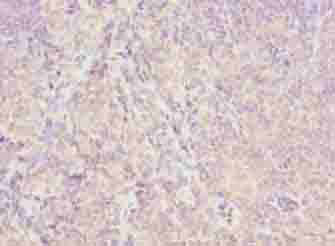 ISA2 / ISCA2 Antibody - Immunohistochemistry of paraffin-embedded human tonsil tissue using antibody at dilution of 1:100.