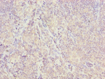 ISA2 / ISCA2 Antibody - Immunohistochemistry of paraffin-embedded human tonsil tissue using ISCA2 Antibody at dilution of 1:100