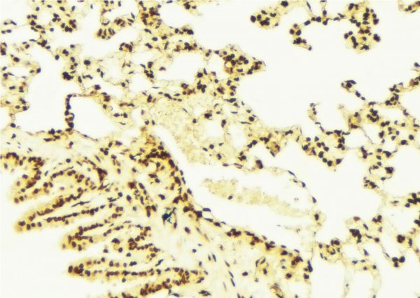 ISCU Antibody - 1:100 staining mouse lung tissue by IHC-P. The sample was formaldehyde fixed and a heat mediated antigen retrieval step in citrate buffer was performed. The sample was then blocked and incubated with the antibody for 1.5 hours at 22°C. An HRP conjugated goat anti-rabbit antibody was used as the secondary.