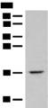ISCU Antibody - Western blot analysis of Mouse lung tissue lysate  using ISCU Polyclonal Antibody at dilution of 1:400