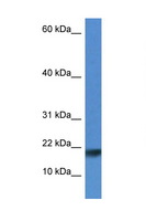 ISCU Antibody - ISCU antibody Western blot of Rat Lung lysate. Antibody concentration 1 ug/ml. This image was taken for the unconjugated form of this product. Other forms have not been tested.