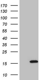 ISG15 Antibody - HEK293T cells were transfected with the pCMV6-ENTRY control (Left lane) or pCMV6-ENTRY ISG15 (Right lane) cDNA for 48 hrs and lysed. Equivalent amounts of cell lysates (5 ug per lane) were separated by SDS-PAGE and immunoblotted with anti-ISG15 (1:2000).