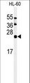 ISG15 Antibody - Western blot of ISG15 Antibody (C-term N151) in HL-60 cell line lysates (35 ug/lane). ISG15 (arrow) was detected using the purified antibody.