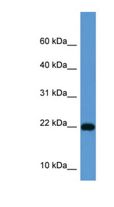 ISG15 Antibody - ISG15 antibody Western blot of Fetal Kidney lysate. This image was taken for the unconjugated form of this product. Other forms have not been tested.