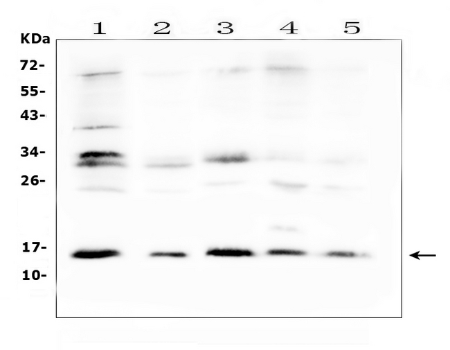 ISG15 Antibody - Western blot analysis of ISG15/Ucrp using anti-ISG15/Ucrp antibody. Electrophoresis was performed on a 5-20% SDS-PAGE gel at 70V (Stacking gel) / 90V (Resolving gel) for 2-3 hours. The sample well of each lane was loaded with 50ug of sample under reducing conditions. Lane 1: mouse spleen tissue lysates, Lane 2: mouse heart tissue lysates, Lane 3: mouse lung tissue lysates, Lane 4: mouse liver tissue lysates, Lane 5: mouse kidney tissue lysates. After Electrophoresis, proteins were transferred to a Nitrocellulose membrane at 150mA for 50 minutes. Blocked the membrane with 5% Non-fat Milk/ TBS for 1.5 hours at RT. The membrane was incubated with rabbit anti-ISG15/Ucrp antigen affinity purified polyclonal antibody at 0.5 µg/mL overnight at 4°C, then washed with TBS-0.1% Tween 3 times with 5 minutes each and probed with a goat anti-rabbit IgG-HRP secondary antibody at a dilution of 1:10000 for 1.5 hour at RT. The signal is developed using an Enhanced Chemiluminescent detection (ECL) kit with Tanon 5200 system. A specific band was detected for ISG15/Ucrp at approximately 15KD. The expected band size for ISG15/Ucrp is at 17KD.