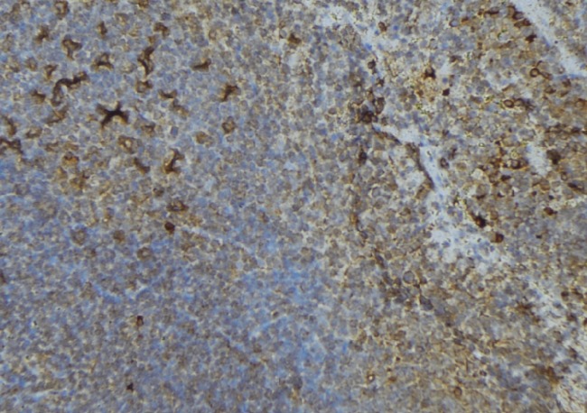 ISG15 Antibody - 1:100 staining human lymph node tissue by IHC-P. The sample was formaldehyde fixed and a heat mediated antigen retrieval step in citrate buffer was performed. The sample was then blocked and incubated with the antibody for 1.5 hours at 22°C. An HRP conjugated goat anti-rabbit antibody was used as the secondary.