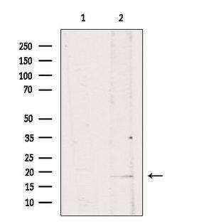 ISG15 Antibody - Western blot analysis of extracts of mouse brain tissue using ISG15 antibody. Lane 1 was treated with the blocking peptide.