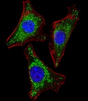 ISG15 Antibody - Immunofluorescent analysis of 4% paraformaldehyde-fixed, 0.1% Triton X-100 permeabilized HeLa (human cervical epithelial adenocarcinoma cell line) cells labeling ISG15 with ISG15 Antibody (N-term)) at 1/25 dilution, followed by Dylight® 488-conjugated goat anti-mouse IgG (NA166821) secondary antibody at 1/200 dilution (green). Immunofluorescence image showing cytoplasm staining on HeLa cell line. Cytoplasmic actin is detected with Dylight® 554 Phalloidin (PD18466410) at 1/100 dilution (red).The nuclear counter stain is DAPI (blue).