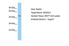 ISG20L2 Antibody -  This image was taken for the unconjugated form of this product. Other forms have not been tested.