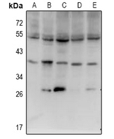 ISG20L2 Antibody - Western blot analysis of ISG20L2 expression in SGC7901 (A), PC12 (B), BV2 (C), A549 (D), LO2 (E) whole cell lysates.