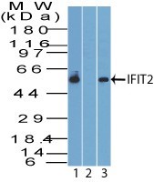 ISG54 / IFIT2 Antibody - Western Blot: IFIT2 Antibody - Analysis of IFIT2 in human K562 lysate in the 1) absence and 2) presence of immunizing peptide, and 3) mouse RAW lysate probed with 4 ug/ml of IFIT2 antibody. Goat anti-rabbit Ig HRP secondary antibody and PicoTect ECL substrate solution were used for this test.