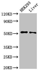 ISG54 / IFIT2 Antibody - Western Blot Positive WB detected in:HEK293 whole cell lysate,Rat liver tissue All Lanes:IFIT2 antibody at 3µg/ml Secondary Goat polyclonal to rabbit IgG at 1/50000 dilution Predicted band size: 55 KDa Observed band size: 55 KDa