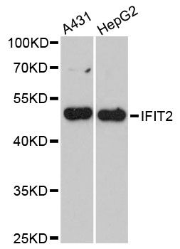ISG54 / IFIT2 Antibody - Western blot analysis of extracts of various cell lines, using IFIT2 antibody at 1:3000 dilution. The secondary antibody used was an HRP Goat Anti-Rabbit IgG (H+L) at 1:10000 dilution. Lysates were loaded 25ug per lane and 3% nonfat dry milk in TBST was used for blocking. An ECL Kit was used for detection and the exposure time was 90s.