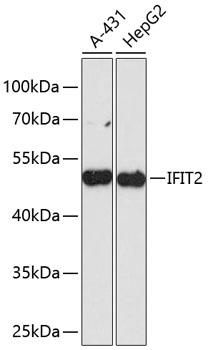 ISG54 / IFIT2 Antibody - Western blot analysis of extracts of various cell lines using IFIT2 Polyclonal Antibody at dilution of 1:3000.
