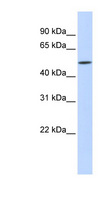 ISG54 / IFIT2 Antibody - IFIT2 antibody Western blot of Fetal Liver lysate. This image was taken for the unconjugated form of this product. Other forms have not been tested.
