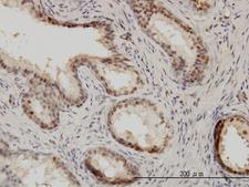 ISGF3 / IRF9 Antibody - Immunoperoxidase of monoclonal antibody to ISGF3G on formalin-fixed paraffin-embedded human prostate. [antibody concentration 3 ug/ml].