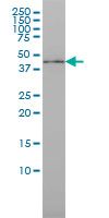 ISGF3 / IRF9 Antibody - ISGF3G monoclonal antibody (M02), clone 1D11 Western blot of ISGF3G expression in MCF-7.