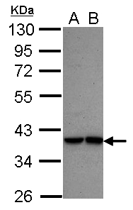ISGF3 / IRF9 Antibody - Sample (30 ug of whole cell lysate) A: A549 B: HeLa 10% SDS PAGE IRF9 antibody diluted at 1:5000