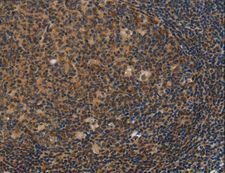 ISGF3 / IRF9 Antibody - Immunohistochemistry of paraffin-embedded Human tonsil using IRF9 Polyclonal Antibody at dilution of 1:50.