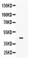 ISGF3 / IRF9 Antibody - Western blot analysis of IRF9 expression in U87 whole cell lysates (lane 1). IRF9 at 44KD was detected using rabbit anti-IRF9 Antigen Affinity purified polyclonal antibody at 0.5 µg/mL. The blot was developed using chemiluminescence (ECL) method.