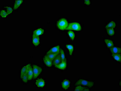 ISGF3 / IRF9 Antibody - Immunofluorescence staining of HepG2 cells with IRF9 Antibody at 1:100, counter-stained with DAPI. The cells were fixed in 4% formaldehyde, permeabilized using 0.2% Triton X-100 and blocked in 10% normal Goat Serum. The cells were then incubated with the antibody overnight at 4°C. The secondary antibody was Alexa Fluor 488-congugated AffiniPure Goat Anti-Rabbit IgG(H+L).