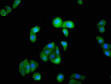 ISGF3 / IRF9 Antibody - Immunofluorescence staining of HepG2 cells with IRF9 Antibody at 1:100, counter-stained with DAPI. The cells were fixed in 4% formaldehyde, permeabilized using 0.2% Triton X-100 and blocked in 10% normal Goat Serum. The cells were then incubated with the antibody overnight at 4°C. The secondary antibody was Alexa Fluor 488-congugated AffiniPure Goat Anti-Rabbit IgG(H+L).
