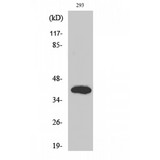 ISL2 / Islet 2 Antibody - Western blot of Islet-2 antibody