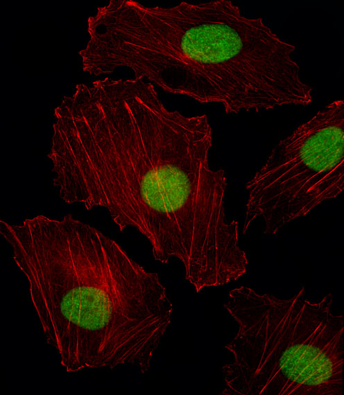 ISL2 / Islet 2 Antibody - Fluorescent image of HUVEC cell stained with ISL2 Antibody. HUVEC cells were fixed with 4% PFA (20 min), permeabilized with Triton X-100 (0.1%, 10 min), then incubated with ISL2 primary antibody (1:25, 1 h at 37°C). For secondary antibody, Alexa Fluor 488 conjugated donkey anti-rabbit antibody (green) was used (1:400, 50 min at 37°C). Cytoplasmic actin was counterstained with Alexa Fluor 555 (red) conjugated Phalloidin (7units/ml, 1 h at 37°C). ISL2 immunoreactivity is localized to Nucleus significantly.