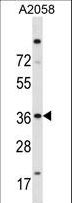 ISL2 / Islet 2 Antibody - ISL2 Antibody western blot of A2058 cell line lysates (35 ug/lane). The ISL2 antibody detected the ISL2 protein (arrow).