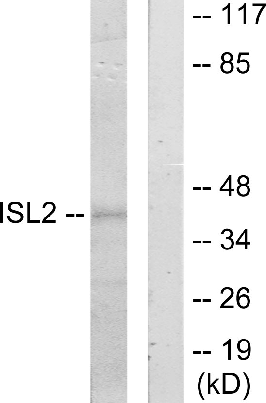 ISL2 / Islet 2 Antibody - Western blot analysis of lysates from 293 cells, using ISL2 Antibody. The lane on the right is blocked with the synthesized peptide.