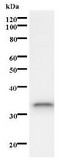 ISL2 / Islet 2 Antibody - Western blot of immunized recombinant protein using ISL2 antibody.