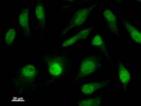 ISL2 / Islet 2 Antibody - Immunostaining analysis in HeLa cells. HeLa cells were fixed with 4% paraformaldehyde and permeabilized with 0.1% Triton X-100 in PBS. The cells were immunostained with anti-ISL2 mAb.