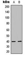 ISL2 / Islet 2 Antibody - Western blot analysis of Islet-2 expression in HEK293T (A); mouse brain (B) whole cell lysates.