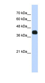 ISL2 / Islet 2 Antibody - ISL2 / Islet 2 antibody Western blot of Transfected 293T cell lysate. This image was taken for the unconjugated form of this product. Other forms have not been tested.