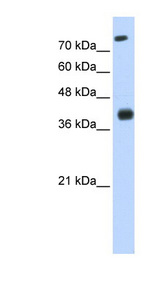 ISL2 / Islet 2 Antibody - ISL2 / Islet 2 antibody Western blot of Transfected 293T cell lysate. This image was taken for the unconjugated form of this product. Other forms have not been tested.