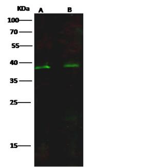 ISL2 / Islet 2 Antibody - Anti-ISL2 rabbit polyclonal antibody at 1:500 dilution. Lane A: 293T Whole Cell Lysate. Lane B: HeLa Whole Cell Lysate. Lysates/proteins at 30 ug per lane. Secondary: Goat Anti-Rabbit IgG H&L (Dylight 800) at 1/10000 dilution. Developed using the Odyssey technique. Performed under reducing conditions. Predicted band size: 40 kDa. Observed band size: 38 kDa.