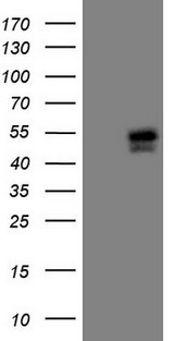 ISLET-1 / ISL1 Antibody - HEK293T cells were transfected with the pCMV6-ENTRY control. (Left lane) or pCMV6-ENTRY ISL1. (Right lane) cDNA for 48 hrs and lysed. Equivalent amounts of cell lysates. (5 ug per lane) were separated by SDS-PAGE and immunoblotted with anti-ISL1. (1:500)