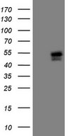 ISLET-1 / ISL1 Antibody - HEK293T cells were transfected with the pCMV6-ENTRY control. (Left lane) or pCMV6-ENTRY ISL1. (Right lane) cDNA for 48 hrs and lysed. Equivalent amounts of cell lysates. (5 ug per lane) were separated by SDS-PAGE and immunoblotted with anti-ISL1. (1:500)