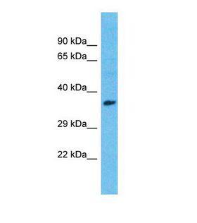 ISLET-1 / ISL1 Antibody - Western blot of Human Breast Tumor. ISL1 antibody dilution 1.0 ug/ml.  This image was taken for the unconjugated form of this product. Other forms have not been tested.